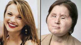 Zdrowie w pakiecie , LIFESTYLE - Świadomość na temat zdrowego trybu życia wzrasta. Ciągle jednak zdecydowanie za mało osób dba o profilaktykę, która jest nieodłącznym elementem zachowania prawidłowej kondycji organizmu.