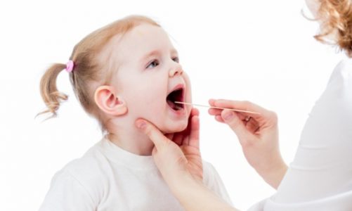 Twoje dziecko nieustannie boli gardło? To może być migdałek!