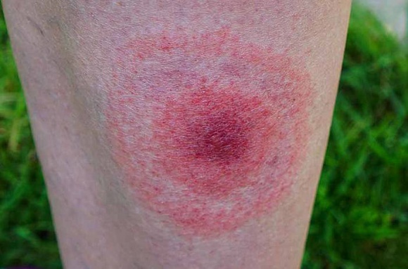 glownekonf_2131214323w_580_small Ruszają ogólnopolskie badania dotyczące jakości życia z HIV/AIDS