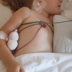 Pomóżmy małej Oliwce odzyskać sprawną rękę. Brakuje tylko 15 000 zł!
